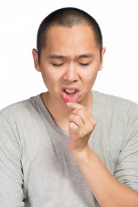 Man With Canker Sore On Lip